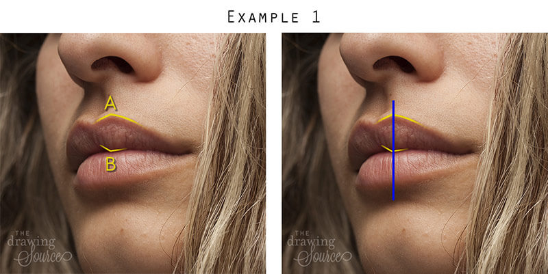 Checking the alignment of the lips using a vertical axis line